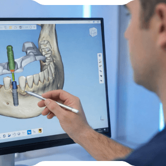 Ağrısız ve Hızlı İmplant:<br/> Dijital İmplant Planlama, 3D Tomografi ve Rehberli Cerrahi