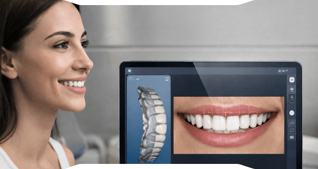 Hollywood Smile ve Dijital Gülüş Tasarımı:,[object Object], Yeni Gülüşünüzü Tedaviye Başlamadan Aynada Görün