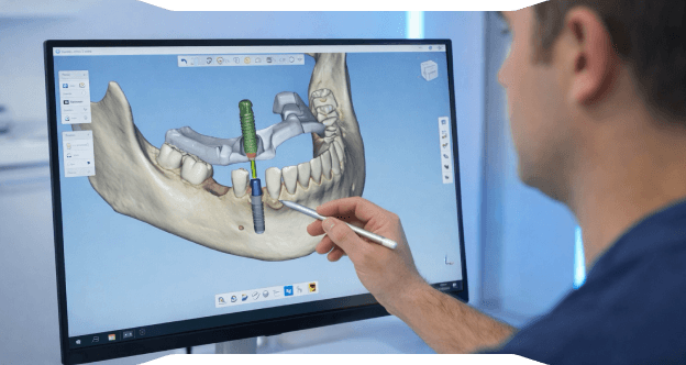 Ağrısız ve Hızlı İmplant:,[object Object], Dijital İmplant Planlama, 3D Tomografi ve Rehberli Cerrahi